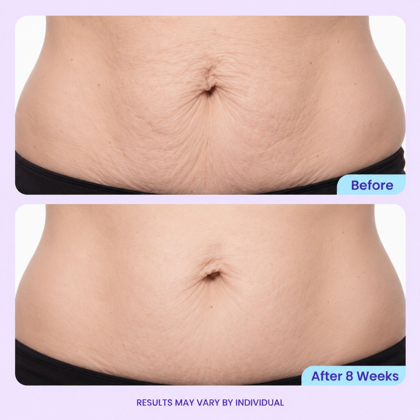 Tighten & Smooth Belly Cream