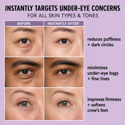 Temporary Eye Tightener