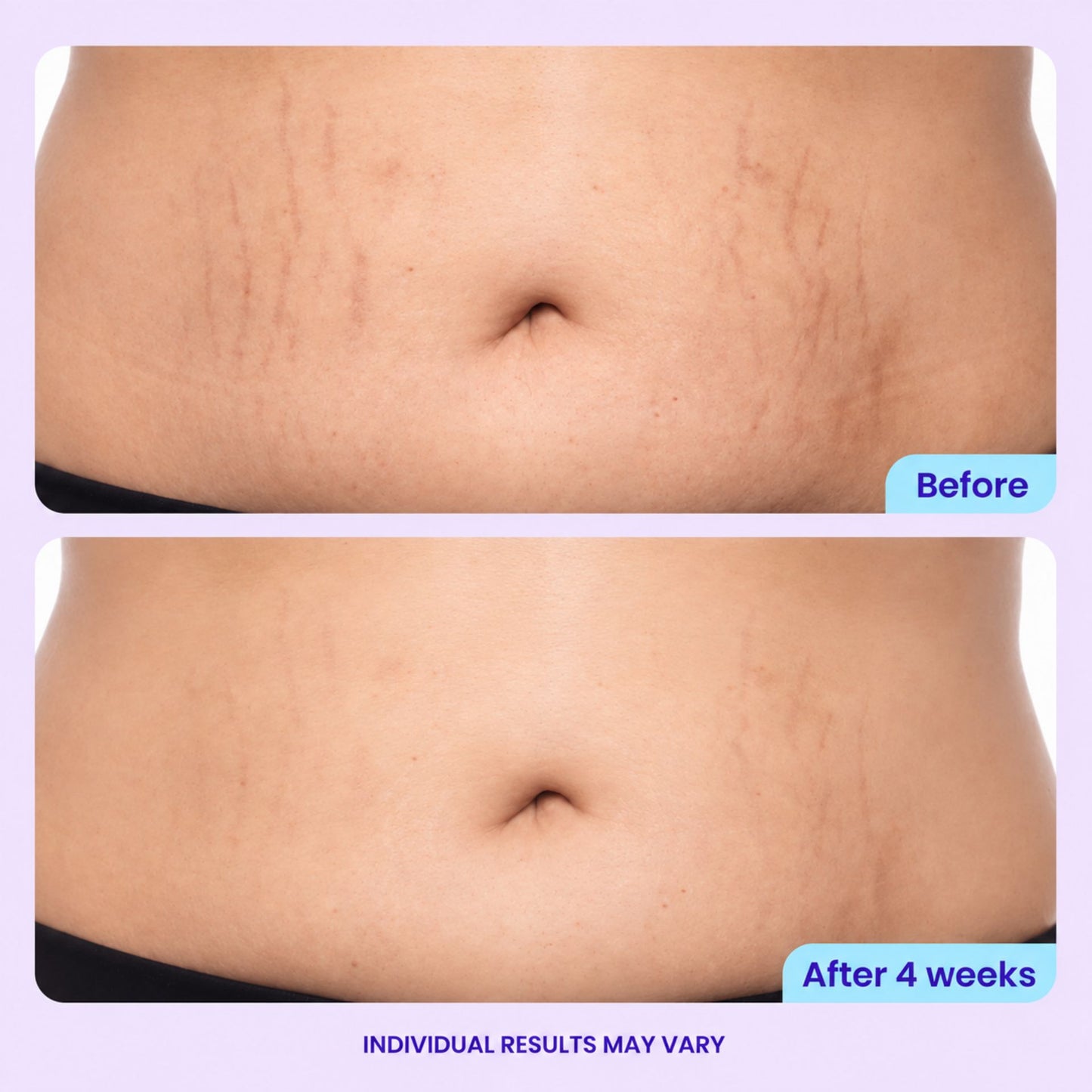 Tighten & Smooth Belly Cream