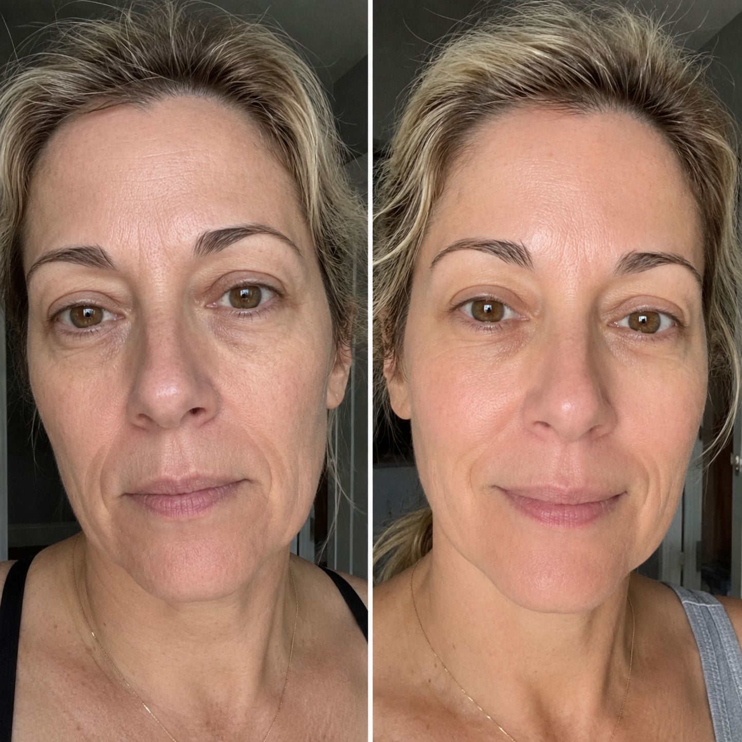 100% Volufiline Ampoule