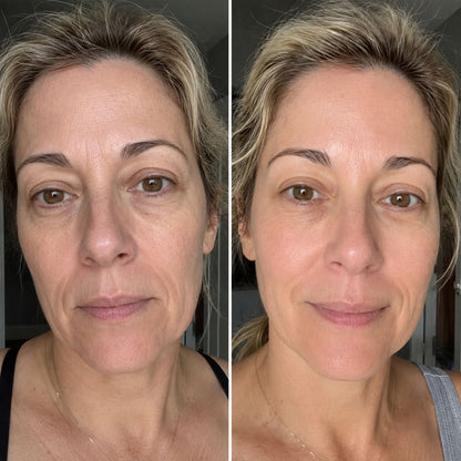 100% Volufiline Ampoule
